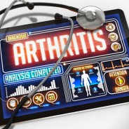 Chondroitin For Arthritis: Benefits & Information